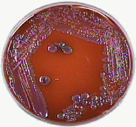 Mucoid-looking almost iridescent Enterobacter aerogenes growing on EMB agar