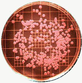 Pinkish colonies of Enterobacter aerogenes growing on MacConkey agar