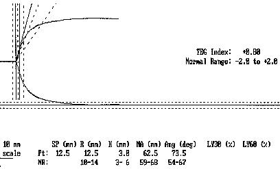 Normal TEG Tracing