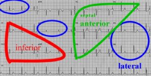 groups of ECG leads