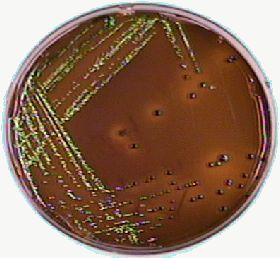 Escherichia coli growing on MacConkey agar. Note greenish sheen
