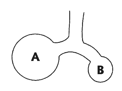 Picture of two alveoli of different sizes