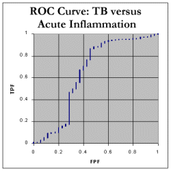 ROC curve for ADA in pleural fluid: distinction between tuberculosis and acute inflammatory disorders